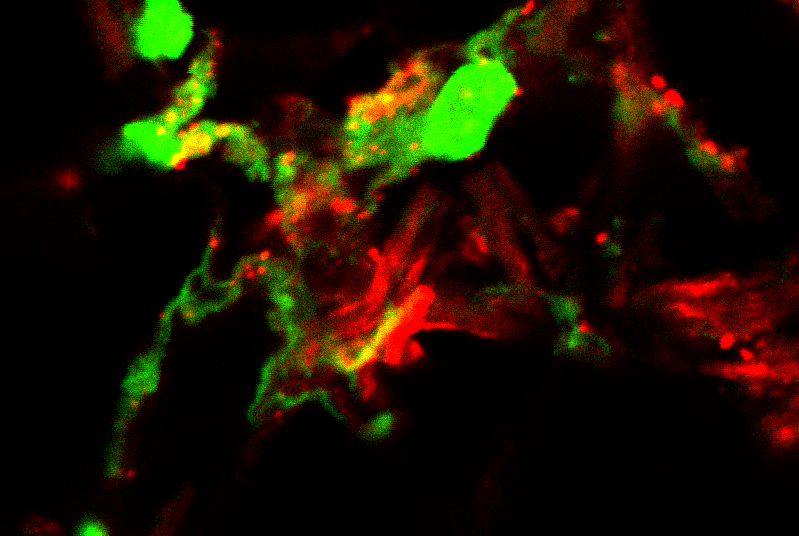 colocalization of extracellular DNA and CXCL4