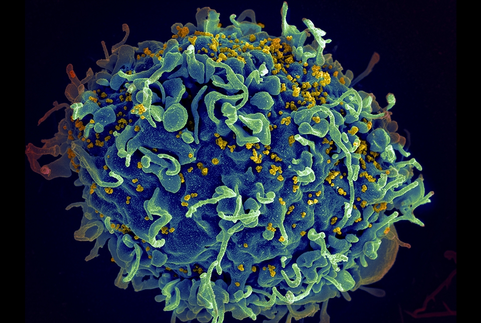 HIV infecting T cell