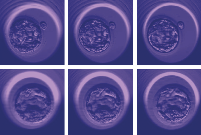  microscopic images show three examples of early-stage human embryos of varying quality