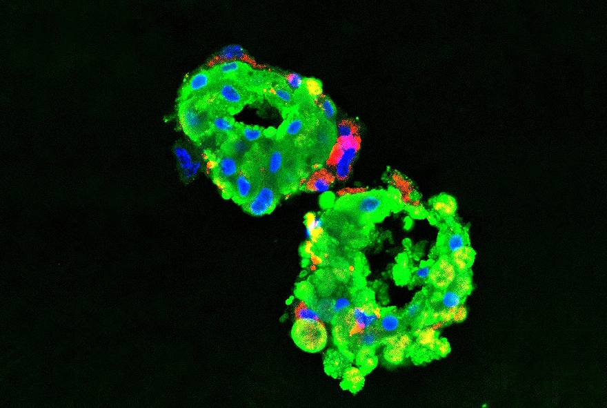 organoids under a microscope