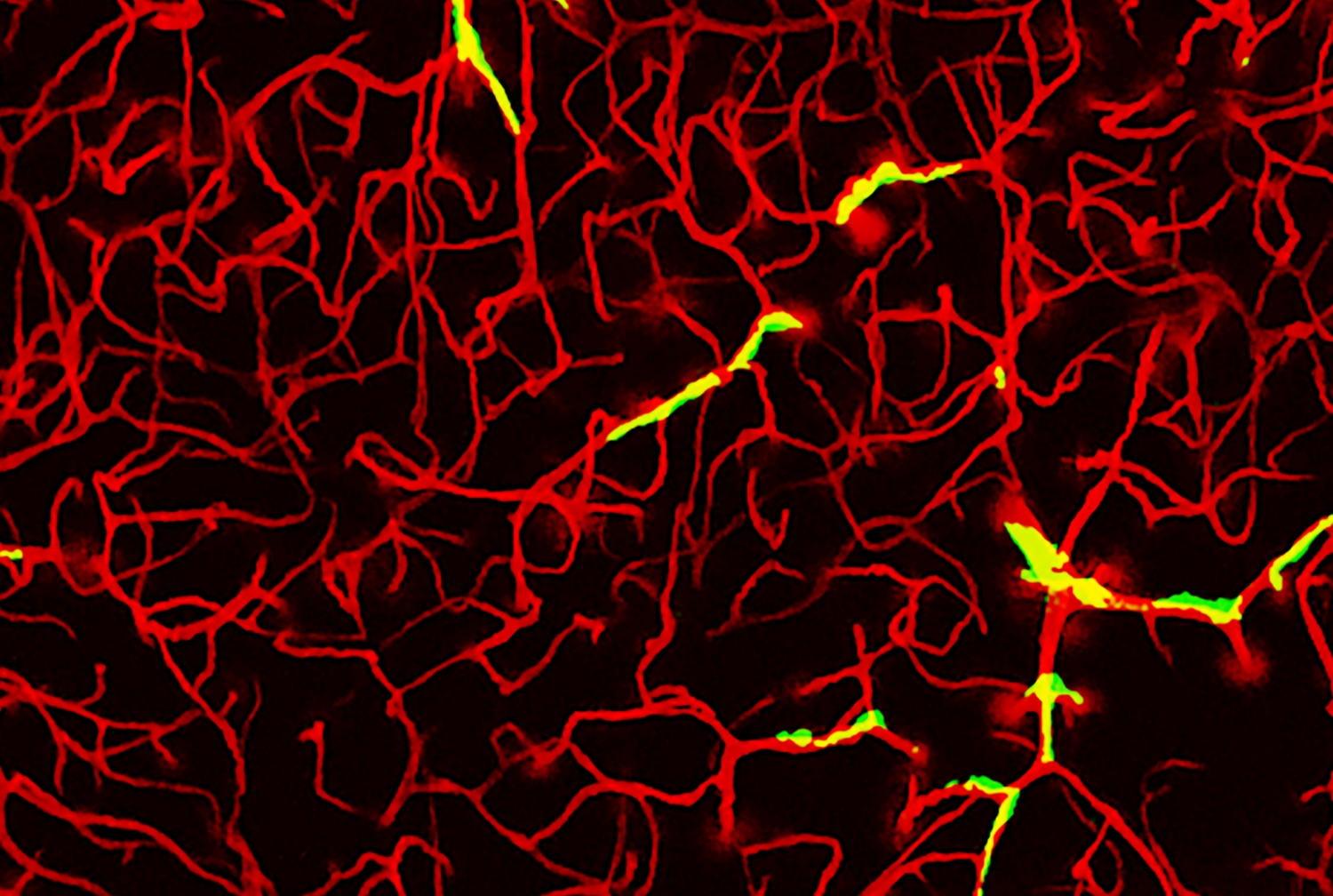 microscopic image of brain cells