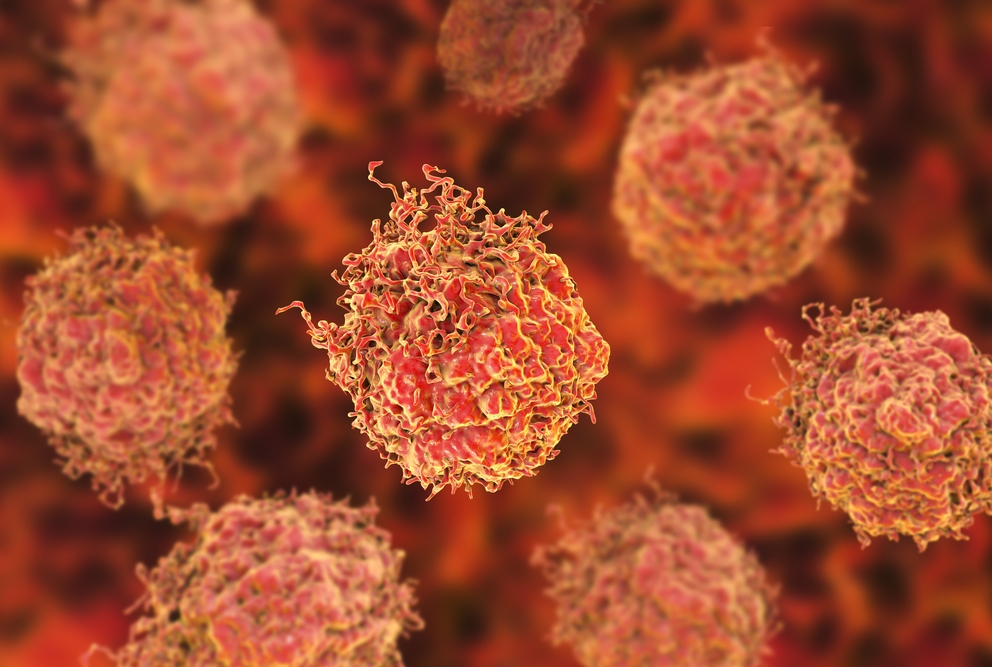 prostate cancer cells stock image concept